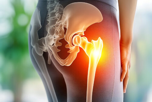 Female Hip Pain and Backache A Detailed Look at Joint and Bone Anatomy